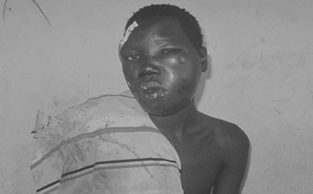 An injured bodaboda operator receiving treatment at Bor Teaching hospital [©Gurtong]